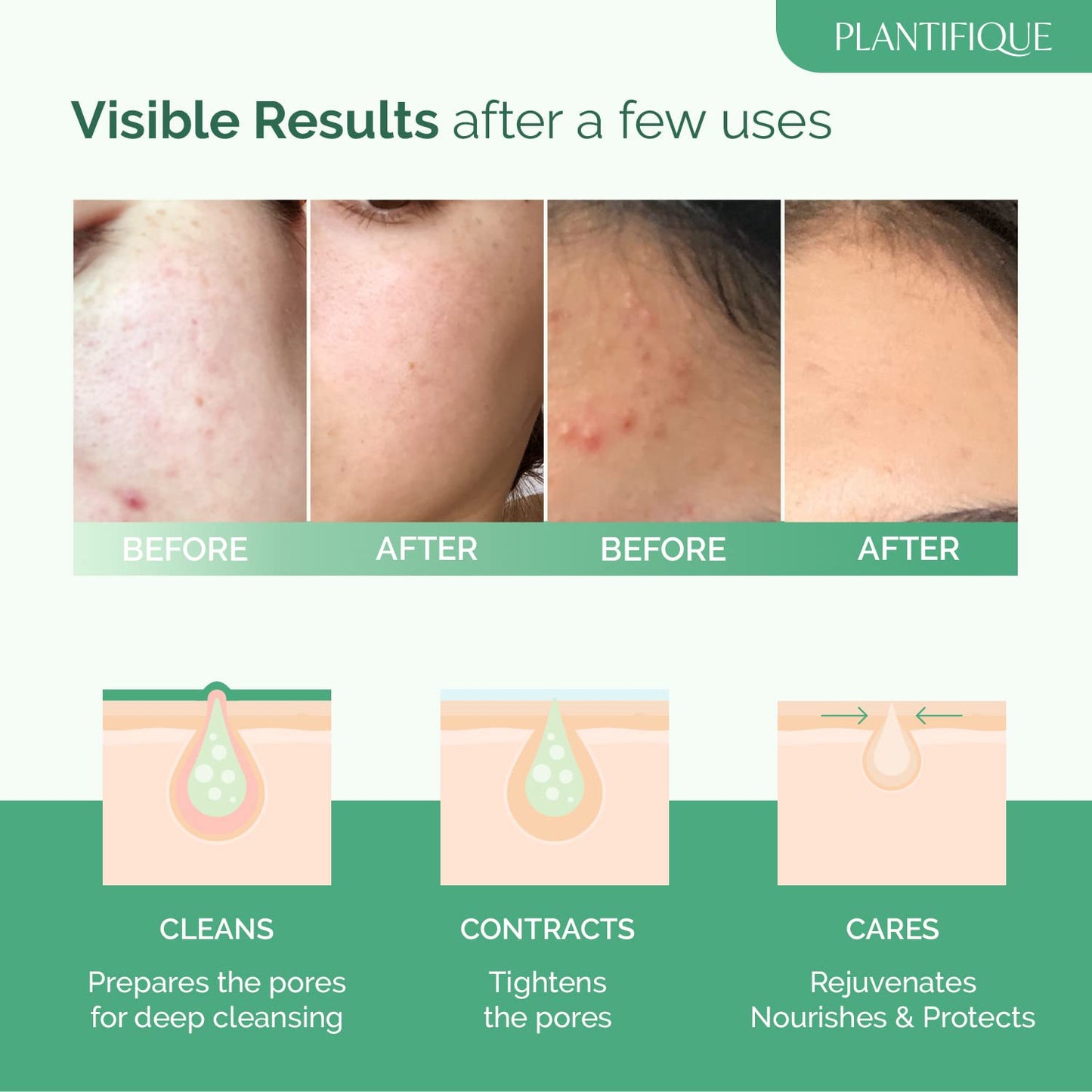 Skin Care Detox Face Mask with Avocado & Superfoods - Hydrating Clay Mud Mask Dermatologist Tested for Face and Body - Vegan Skincare 3.4 Oz/100Ml