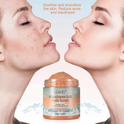 Natural Himalayan Exfoliating Salt Body Scrub for Acne, Blackheads, & Deep Cleansing
