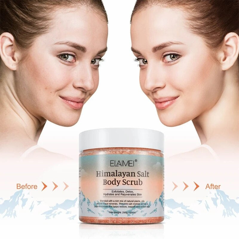 Natural Himalayan Exfoliating Salt Body Scrub for Acne, Blackheads, & Deep Cleansing